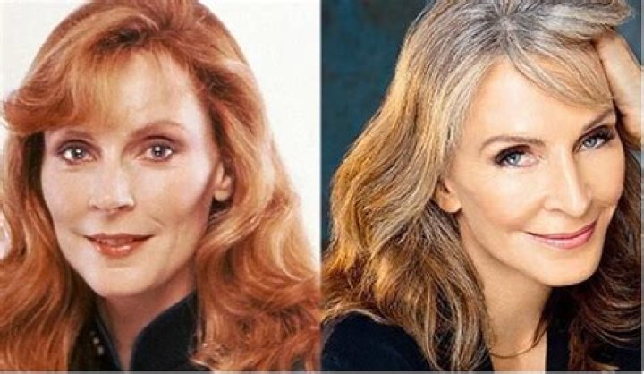 Gates McFadden's Plastic Surgery Journey Revealed