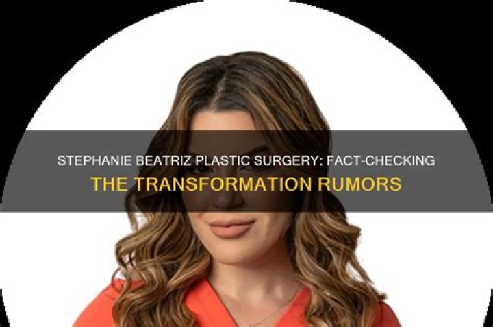 Truth About Stephanie Beatrizs Plastic Surgery Rumors