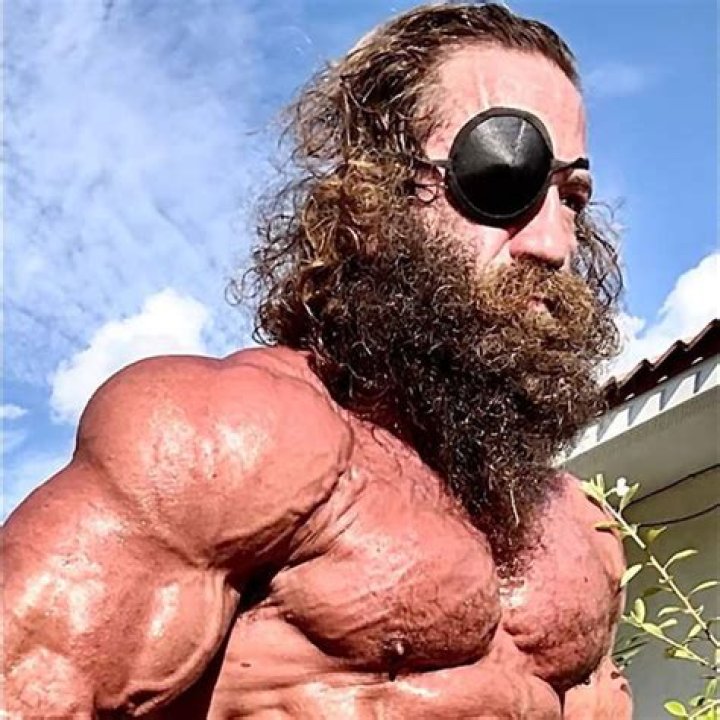 What Happened to Liver King's Eye? He May Just Lose It